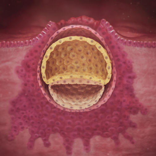 морула бластоциста