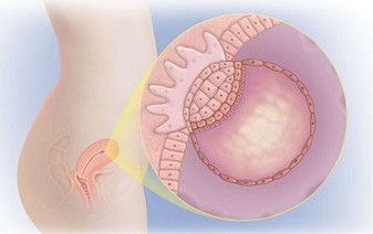 тело 3 неделя беременности