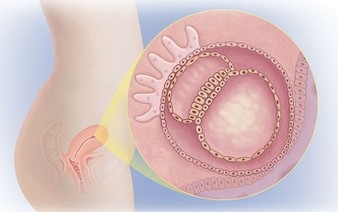 тело 4 неделя беременности